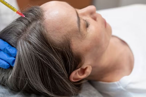 Hair Transplant Treatments